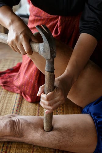 Traditionelle Behandlung, junge Frau behandelt Oberschenkel mit mit Holz und Hammer